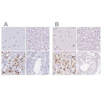 <b>Independent Antibodies Validation. </b>Immunohistochemistry-Paraffin: MiRP1 Antibody [NBP2-38653] - Staining of human cerebral cortex, liver, stomach and testis using Anti-KCNE2 antibody NBP2-38653 (A) shows similar protein distribution across tissues to independent antibody NBP2-38146 (B).