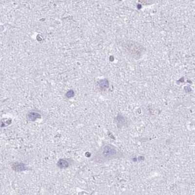 Immunohistochemistry-Paraffin: MiRP1 Antibody [NBP2-38653] - Staining of human cerebral cortex.