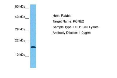 Western Blot: MiRP1 Antibody [NBP2-85288] - Host: Rabbit. Target Name: KCNE2. Sample Tissue: Human DLD1 Whole Cell lysates. Antibody Dilution: 1ug/ml