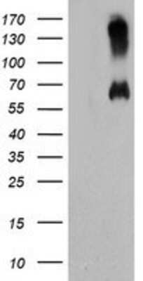 Western Blot: Mic1 Antibody (4E4) [NBP2-01949] HEK293T cells were transfected with the pCMV6-ENTRY control (Left lane) or pCMV6-ENTRY Mic1 (Right lane) cDNA for 48 hrs and lysed. Equivalent amounts of cell lysates (5 ug per lane) were separated by SDS-PAGE and immunoblotted with anti-Mic1.