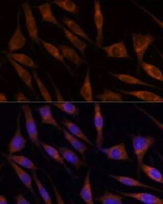 Immunocytochemistry/Immunofluorescence: Mic1 Antibody [NBP3-03433] - Analysis of L929 cells using Mic1 antibody at dilution of 1:100. Blue: DAPI for nuclear staining.