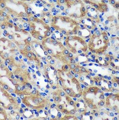 Immunohistochemistry-Paraffin: Mic1 Antibody [NBP3-03433] - Mouse kidney using Mic1  Rabbit pAb at dilution of 1:100 (40x lens).