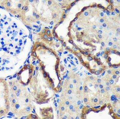 Immunohistochemistry-Paraffin: Mic1 Antibody [NBP3-03433] - Rat kidney using Mic1 Rabbit pAb at dilution of 1:100 (40x lens).