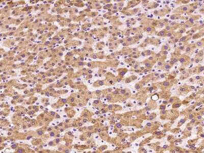 Immunohistochemistry-Paraffin: Microsomal Glutathione S-transferase 1 Antibody [NBP2-97486] - Immunochemical staining of human Microsomal Glutathione S-transferase 1 in human liver with rabbit polyclonal antibody at 1:100 dilution, formalin-fixed paraffin embedded sections.