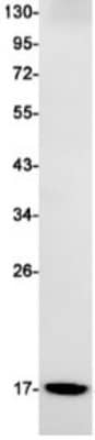 Western Blot: Microsomal Glutathione S-transferase 1 Antibody (S06-1E9) [NBP3-19501] - Western blot detection of Microsomal Glutathione S-transferase 1 in Rat Liver cell lysates using NBP3-19501 (1:1000 diluted). Predicted band size: 18kDa. Observed band size: 18kDa.