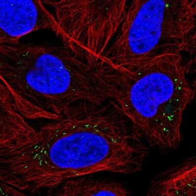 Immunocytochemistry/Immunofluorescence: Midkine Antibody [NBP2-55458] - Staining of human cell line U-2 OS shows localization to vesicles.