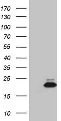 Western Blot: Midkine Antibody (OTI6C8) - Azide and BSA Free [NBP2-72682] - Analysis of HEK293T cells were transfected with the pCMV6-ENTRY control (Left lane) or pCMV6-ENTRY Midkine.