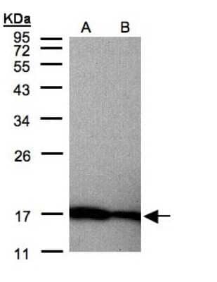 Western Blot: Midkine Antibody [NBP1-31158] - Sample(30 ug of whole cell lysate)A:HeLa S3 B:Hep G2 12% SDS PAGE, antibody diluted at 1:200.