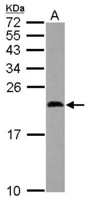 Western Blot: Midkine Antibody [NBP2-17289] - Sample (30 ug of whole cell lysate) A: MCF-7 15% SDS PAGE gel, diluted at 1:1000.