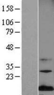 Western Blot: Midkine Overexpression Lysate (Adult Normal) [NBL1-12968] Left-Empty vector transfected control cell lysate (HEK293 cell lysate); Right -Over-expression Lysate for Midkine.