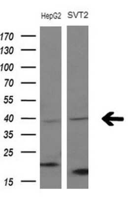 Western Blot: Migfilin Antibody (OTI3G1) - Azide and BSA Free [NBP2-72691] - Analysis of extracts (10ug) from 2 different cell lines.