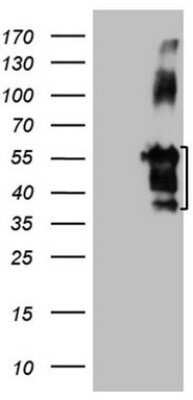 Western Blot: Migfilin Antibody (OTI3G1) - Azide and BSA Free [NBP2-72691] - Analysis of HEK293T cells were transfected with the pCMV6-ENTRY control (Left lane) or pCMV6-ENTRY Migfilin.