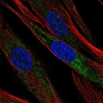 Immunocytochemistry/Immunofluorescence: Mimecan/OIF Antibody [NBP1-87766] - Staining of human cell line ASC TERT1 shows localization to endoplasmic reticulum. Antibody staining is shown in green.