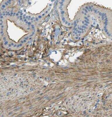 Immunohistochemistry-Paraffin: Mimecan/OIF Antibody [NBP1-87766] - Staining of human gallbladder shows moderate membranous positivity in glandular cells.