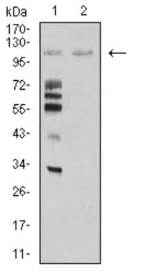 Western Blot: Mind Bomb 1/MIB1 Antibody (6A9C9) [NBP2-61864] - Analysis using MIB1 mouse mAb against Hela (1) and COS7 (2) cell lysate.