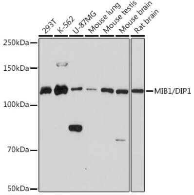 Western Blot: Mind Bomb 1/MIB1 Antibody (9Q4N9) [NBP3-16175] - Western blot analysis of extracts of various cell lines, using Mind Bomb 1/MIB1 Rabbit mAb (NBP3-16175) at 1:1000 dilution. Secondary antibody: HRP Goat Anti-Rabbit IgG (H+L) at 1:10000 dilution. Lysates/proteins: 25ug per lane. Blocking buffer: 3% nonfat dry milk in TBST. Detection: ECL Basic Kit. Exposure time: 3min.