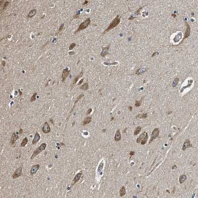 Immunohistochemistry-Paraffin: Mind Bomb 1/MIB1 Antibody [NBP1-85210] - Staining of human hippocampus shows moderate cytoplasmic positivity in neuronal cells.