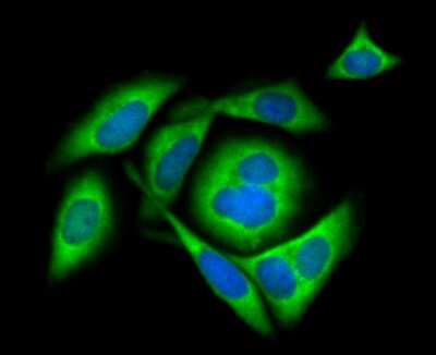 Immunocytochemistry/Immunofluorescence: Mind Bomb 1/MIB1 Antibody (JG69-34) [NBP2-76849] - ICC staining Mib1 in SiHa cells (green). The nuclear counter stain is DAPI (blue). Cells were fixed in paraformaldehyde, permeabilised with 0.25% Triton X100/PBS.