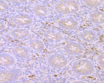 Immunohistochemistry: Mind Bomb 1/MIB1 Antibody (JG69-34) [NBP2-76849] - Immunohistochemical analysis of paraffin-embedded human appendix tissue using anti-Mib1 antibody. Counter stained with hematoxylin.