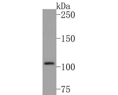 Western Blot: Mind Bomb 1/MIB1 Antibody (JG69-34) [NBP2-76849] - Analysis of Mind Bomb/MIB1 on SH-SY5Y cell lysates with Rabbit anti-Mind Bomb/MIB1 antibody at 1/500 dilution. Lysates/proteins at 10 ug/Lane. Predicted band size: 110 kDa Observed band size: 110 kDa Exposure time: 2 minutes; 6% SDS-PAGE gel. Proteins were transferred to a PVDF membrane and blocked with 5% NFDM/TBST for 1 hour at room temperature. The primary antibody at 1/500 dilution was used in 5% NFDM/TBST at room temperature for 2 hours. Goat Anti-Rabbit IgG - HRP Secondary Antibody at 1:300,000 dilution was used for 1 hour at room temperature.