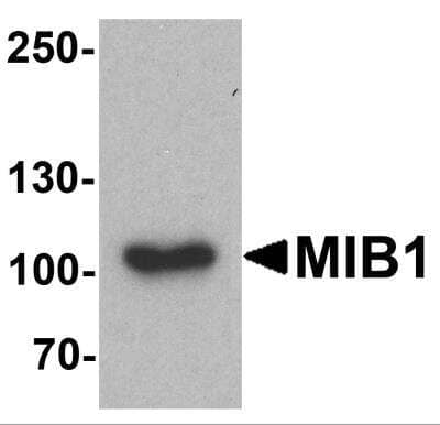 Western Blot: Mind Bomb 1/MIB1 Antibody [NBP2-81754] - Analysis of Mind Bomb 1/MIB1in A431 cell lysate with Mind Bomb 1/MIB1 antibody at 1 ug/ml.