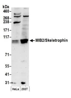 Western Blot: Mind Bomb 2/MIB2 Antibody [NB100-68224] - Detection of Human MIB2/Skeletrophin by Western Blot. Samples: Whole cell lysate (50 ug) from HeLa and 293T cells prepared using NETN lysis buffer. Antibody: Affinity purified rabbit anti-MIB2/Skeletrophin antibody NB100-68224 used for WB at 0.4 ug/ml. Detection: Chemiluminescence with an exposure time of 3 minutes.