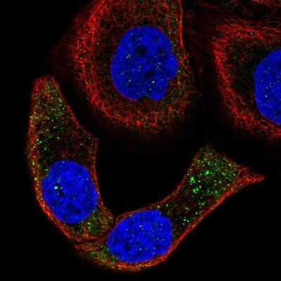 Immunocytochemistry/Immunofluorescence: Mindin/Spondin-2 Antibody [NBP2-57815] - Staining of human cell line HaCaT shows localization to vesicles.