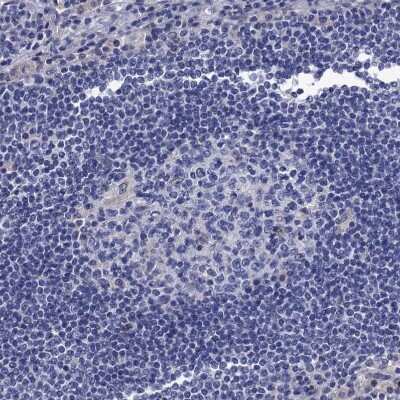 Immunohistochemistry-Paraffin: Mindin/Spondin-2 Antibody [NBP2-30500] - Staining of human lymph node shows no positivity in non-germinal center cells as expected.