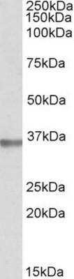 Western Blot: Mindin/Spondin-2 Antibody [NBP1-52031] - NBP1-52031 (1ug/ml) staining of Human Prostate lysate (35ug protein in RIPA buffer). Primary incubation was 1 hour. Detected by chemiluminescence.