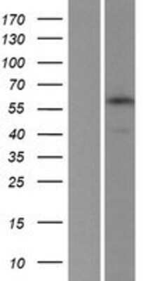 Western Blot APBA3/Mint-3 Overexpression Lysate