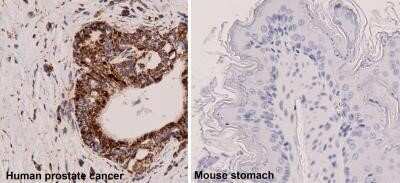 Immunohistochemistry-Paraffin: Mitochondria Antibody (113-1) - Azide and BSA Free [NBP2-34517] - Biotin conjugated Mitochondria expression in human prostate cancer tissue (left) and mouse stomach tissue (right). Image from verified customer review.