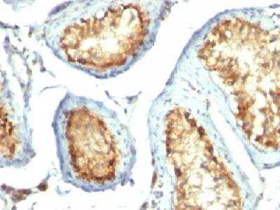 Immunohistochemistry-Paraffin: Mitochondria Antibody (113-1) - Azide and BSA Free [NBP2-34517] - Formalin-fixed, paraffin-embedded human testicular carcinoma stained with mitochondria monoclonal antibody (113-1).