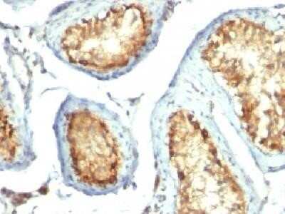 Immunohistochemistry-Paraffin: Mitochondria Antibody (113-1) - IHC-Prediluted [NBP2-45195] - Formalin-fixed, paraffin-embedded human testicular carcinoma stained with mitochondria monoclonal antibody (113-1). Image using the Azide and BSA Free form of this antibody.