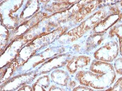 Immunohistochemistry-Paraffin: Mitochondria Antibody (MTC719) [NBP2-32873] - Formalin-fixed, paraffin-embedded human Renal Cell Carcinoma stained with Mitochondria Monoclonal Antibody (MTC719).