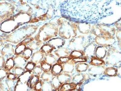 Immunohistochemistry-Paraffin: Mitochondria Antibody (MTC754) [NBP2-32874] - Formalin-fixed, paraffin-embedded human Renal Cell Carcinoma stained with Mitochondria Monoclonal Antibody (MTC754).
