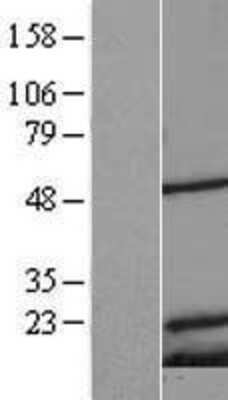 Western Blot: Mitochondrial Ribosomal Protein S18C Overexpression Lysate (Adult Normal) [NBL1-13290] Left-Empty vector transfected control cell lysate (HEK293 cell lysate); Right -Over-expression Lysate for Mitochondrial Ribosomal Protein S18C.