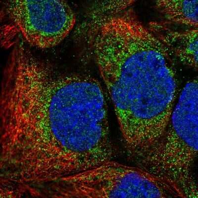 Immunocytochemistry/Immunofluorescence: Mitochondrial fission regulator 1 Antibody [NBP2-55309] - Staining of human cell line A-431 shows localization to cytosol & mitochondria.