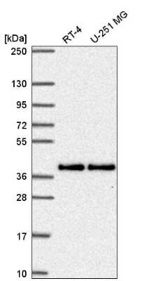 Western Blot: Mitochondrial fission regulator 1 Antibody [NBP2-55309] - Analysis in human cell line RT-4 and human cell line U-251 MG.