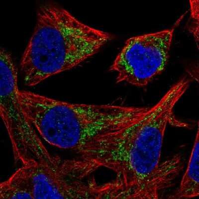 Immunocytochemistry/Immunofluorescence: Mitochondrial-processing peptidase subunit beta Antibody [NBP2-56461] - Staining of human cell line SK-MEL-30 shows localization to mitochondria.