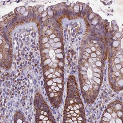 Immunohistochemistry-Paraffin Mitochondrial-processing peptidase subunit beta Antibody