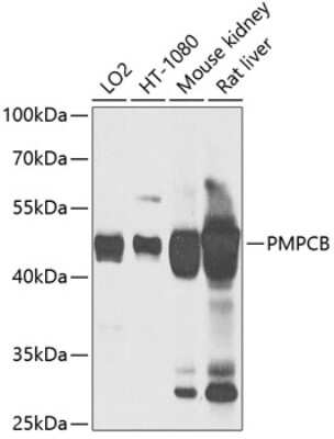 Western Blot: Mitochondrial-processing peptidase subunit beta Antibody [NBP3-03227] - Analysis of extracts of various cell lines, using Mitochondrial-processing peptidase subunit beta antibody at 1:1000 dilution. Secondary antibody: HRP Goat Anti-Rabbit IgG (H+L) at 1:10000 dilution. Lysates/proteins: 25ug per lane. Blocking buffer: 3% nonfat dry milk in TBST. Detection: ECL Basic Kit.