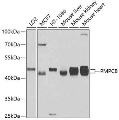 Western Blot Mitochondrial-processing peptidase subunit beta Antibody - BSA Free