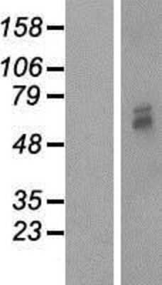 Western Blot: Mitochondrial-processing peptidase subunit beta Overexpression Lysate (Adult Normal) [NBP2-10580] Left-Empty vector transfected control cell lysate (HEK293 cell lysate); Right -Over-expression Lysate for Mitochondrial-processing peptidase subunit beta.