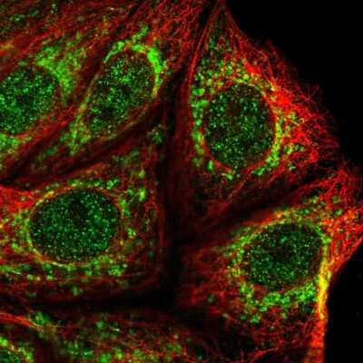 Immunocytochemistry/Immunofluorescence: Mitochondrial ribonuclease P protein 3 Antibody [NBP2-13619] - Immunofluorescent staining of human cell line MCF7 shows localization to nucleoplasm & mitochondria.