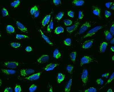 Immunocytochemistry/Immunofluorescence: Mitochondrial ribonuclease P protein 3 Antibody [NBP3-12679] - Staining of MRPP3 in U2OS cells. Cells were fixed with 4% PFA, permeabilzed with 0.3% Triton X-100 in PBS,blocked with 10% serum, and incubated with rabbit anti-Human MRPP3 polyclonal antibody (dilution ratio 1:200) at 4? overnight. Then cells were stained with the Alexa Fluor®488-conjugated Goat Anti-rabbit IgG secondary antibody (green) and counterstained with DAPI (blue).Positive staining was localized to Cytoplasm.