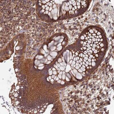 Immunohistochemistry-Paraffin: Mitochondrial ribonuclease P protein 3 Antibody [NBP2-13619] - Staining of human rectum shows strong cytoplasmic positivity in glandular cells.