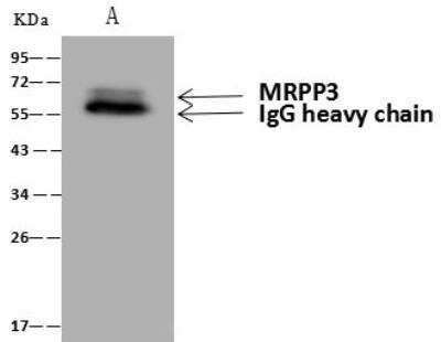 Immunoprecipitation: Mitochondrial ribonuclease P protein 3 Antibody [NBP3-12679] - Lane A:0.5 mg 293 Whole Cell Lysate4 uL anti-MRPP3 rabbit polyclonal antibody and 60 ug of Immunomagnetic beads Protein A/G.Primary antibody:Anti-MRPP3 rabbit polyclonal antibody,at 1:100 dilution Secondary antibody:Goat Anti-Rabbit IgG (H+L)/HRP at 1/10000 dilutionDeveloped using the ECL technique.Performed under reducing conditions.Predicted band size: 67 kDaObserved band size :67 kDa