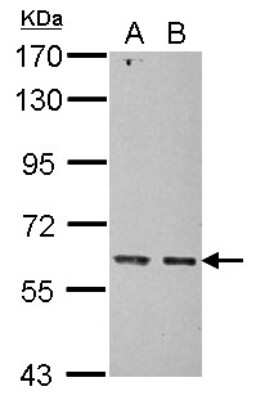 Western Blot: Mitochondrial ribonuclease P protein 3 Antibody [NBP2-17295] - Sample (30 ug of whole cell lysate) A: U87-MG B: SK-N-SH 7. 5% SDS PAGE gel, diluted at 1:5000.