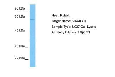 Western Blot: Mitochondrial ribonuclease P protein 3 Antibody [NBP2-85290] - Host: Rabbit. Target Name: KIAA0391. Sample Tissue: Human U937 Whole Cell lysates. Antibody Dilution: 1ug/ml
