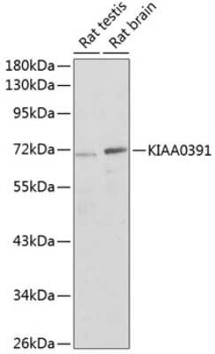 Western Blot: Mitochondrial ribonuclease P protein 3 Antibody [NBP3-03673] - Analysis of extracts of various cell lines, using Mitochondrial ribonuclease P protein 3 antibody at 1:1000 dilution. Secondary antibody: HRP Goat Anti-Rabbit IgG (H+L) at 1:10000 dilution. Lysates/proteins: 25ug per lane.Blocking buffer: 3% nonfat dry milk in TBST.